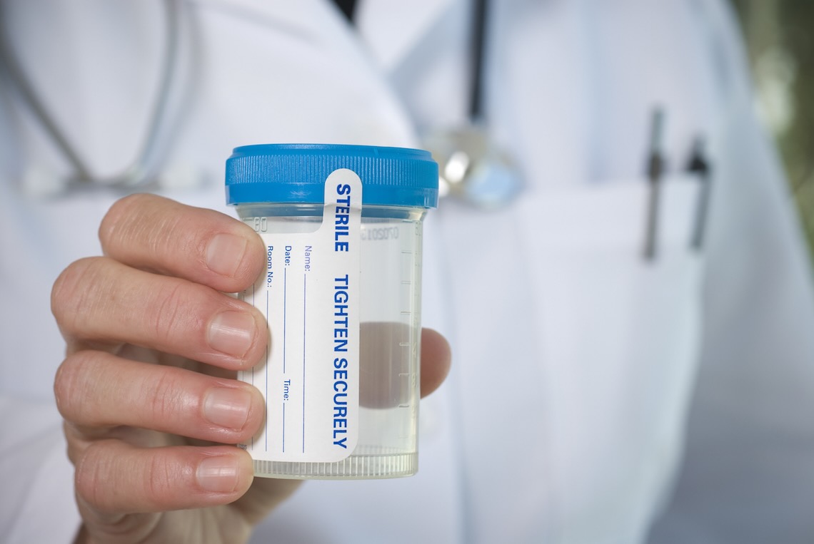 Can a Landlord Require a Drug Test?